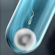 卵巢巧克力囊肿做泰国试管费用是多少？