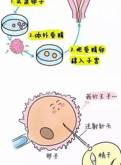 哈萨克斯坦三代试管价格，去哈萨克斯坦做试管婴儿