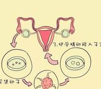 2026年云南省三代试管价格及助孕费用详细解析
